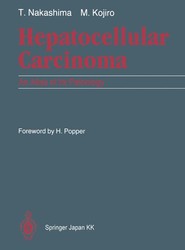 Hepatocellular Carcinoma