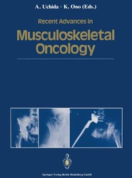 Recent Advances in Musculoskeletal Oncology