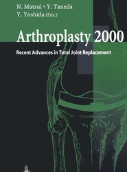Arthroplasty 2000