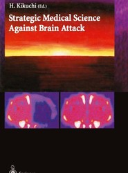 Strategic Medical Science Against Brain Attack