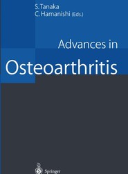 Advances in Osteoarthritis