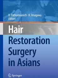 Hair Restoration Surgery in Asians