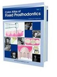 Color Atlas of Fixed Prosthodontics: Vol 1