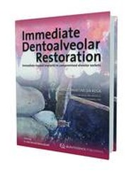 Immediate Dentoalveolar Restoration: Immediately Loaded Implants in Compromised Sockets