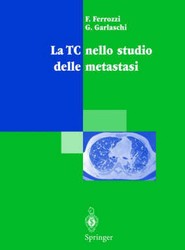 La Tc Nello Studio Delle Metastasi