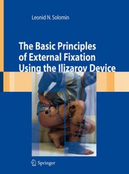 The Basic Principles of External Skeletal Fixation Using the Ilizarov Device