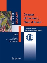 Diseases of the Heart, Chest & Breast
