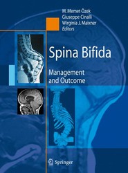 Spina Bifida