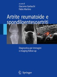 Artrite reumatoide e spondiloentesoartriti