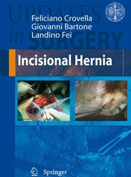 Incisional Hernia