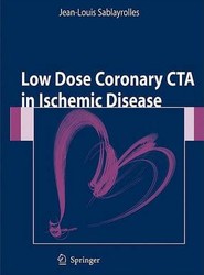 Low Dose Coronary CTA in Ischemic Disease