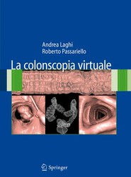 La colonscopia virtuale