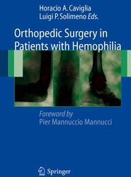 Orthopedic Surgery in Patients with Hemophilia