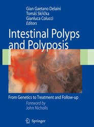 Intestinal Polyps and Polyposis