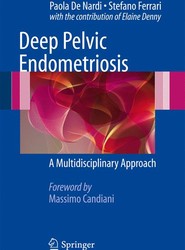 Deep Pelvic Endometriosis