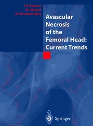 Avascular Necrosis of the Femoral Head: Current Trends