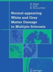 Normal-appearing White and Grey Matter Damage in Multiple Sclerosis