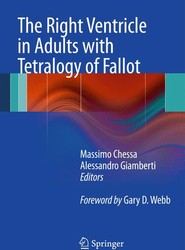 The Right Ventricle in Adults with Tetralogy of Fallot