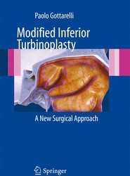 Modified Inferior Turbinoplasty