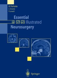 Essential Illustrated Neurosurgery