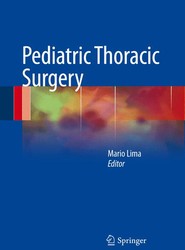 Pediatric Thoracic Surgery