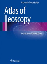 Atlas of Ileoscopy