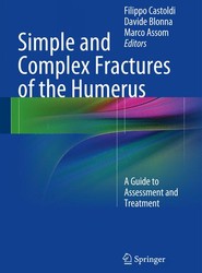 Simple and Complex Fractures of the Humerus