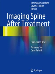Imaging Spine After Treatment