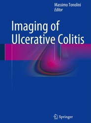 Imaging of Ulcerative Colitis