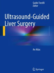 Ultrasound-Guided Liver Surgery
