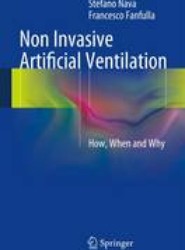 Non Invasive Artificial Ventilation