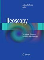 Ileoscopy