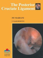 Posterior Cruciate Ligament