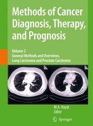 Methods of Cancer Diagnosis, Therapy and Prognosis
