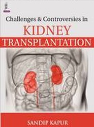 Challenges and Controversies in Kidney Transplantation