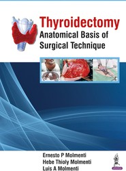 Thyroidectomy