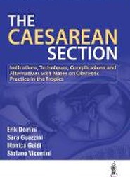 The Caesarean Section