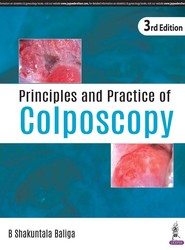 Principles and Practice of Colposcopy