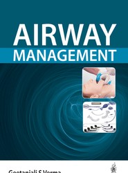 Airway Management