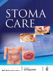 Stoma Care