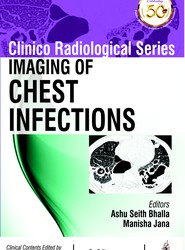 Clinico Radiological Series: Imaging of Chest Infections