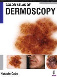 Color Atlas of Dermoscopy