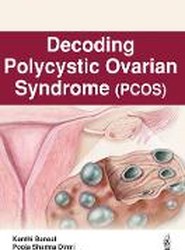 Decoding Polycystic Ovarian Syndrome