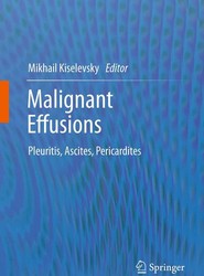 Malignant Effusions