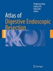Atlas of Digestive Endoscopic Resection