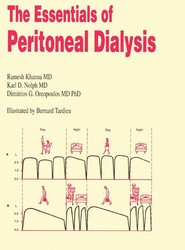 The Essentials of Peritoneal Dialysis