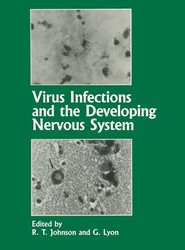 Virus Infections and the Developing Nervous System
