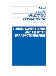 Tumours, Lymphomas and Selected Paraproteinaemias