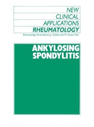 Ankylosing Spondylitis