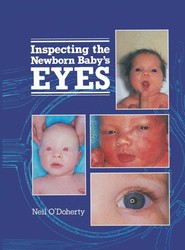 Inspecting the Newborn Baby's Eyes